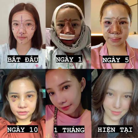 Diễn viên Lưu Đê Ly lần đầu nói về ồn ào đời tư - ảnh 0 dien vien luu de ly lan dau noi ve on ao doi tu - anh 0